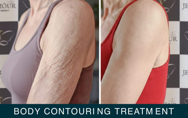 Body contouring treatment by jeamour clinic