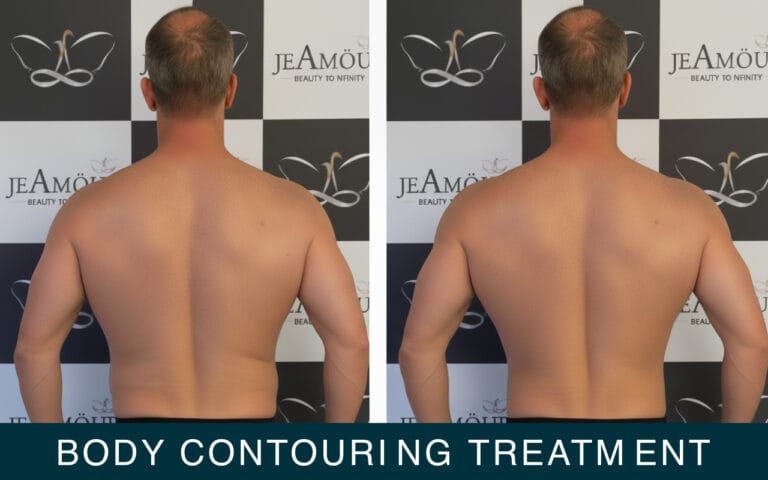 Body contouring treatment for men by jeamour clinic