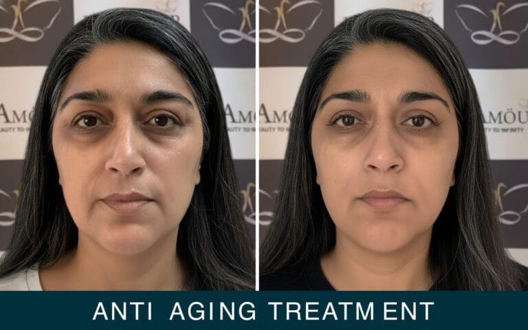 Anti aging treatment by jeamour clinic in chandigarh